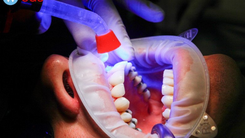 Urgent Dental Care in Magnolia, IA 51550 - Smile with Confidence