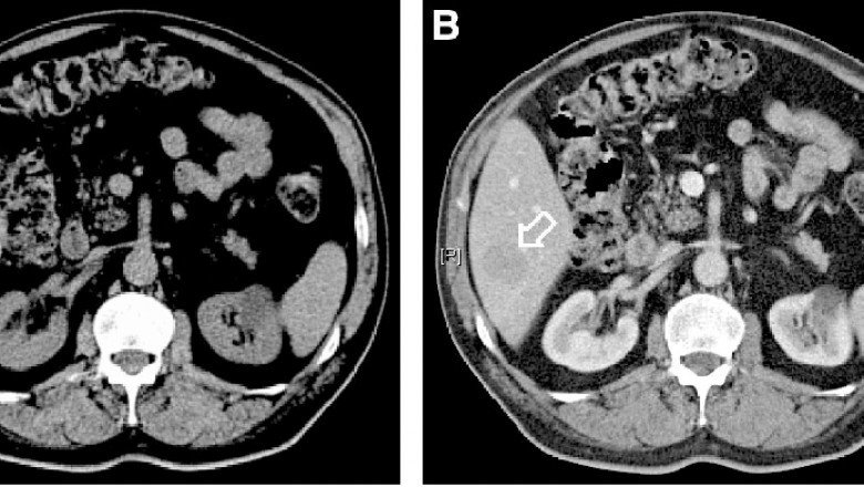 In Medical Imaging, Contrast Media Or Contrast Agents Add Contrast To Structures Or Fluids Within The Body