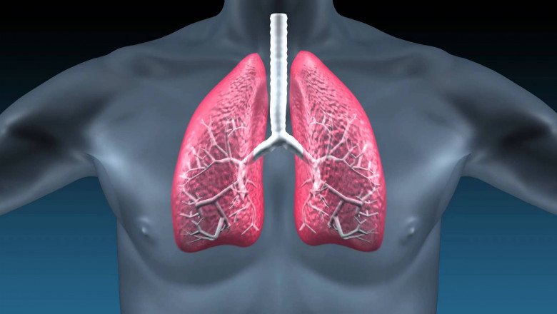 A study of the global Idiopathic Pulmonary Fibrosis Treatment Market : trends, market size, growth, opportunity, as well as forecasts for 2022-2028