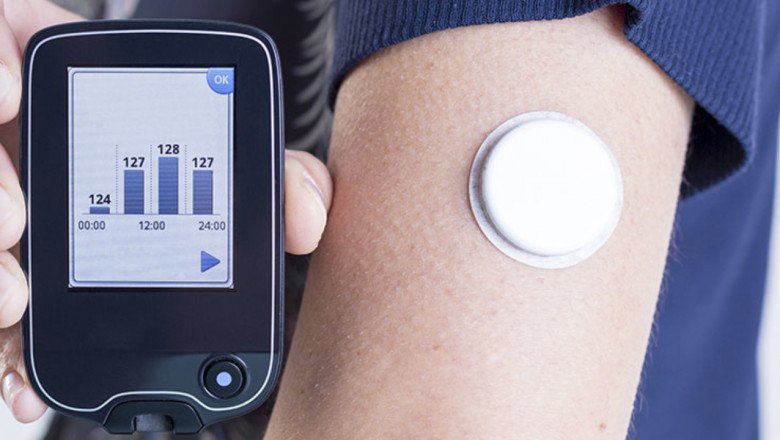 When You Use A Diabetes Monitoring Device, The Sensor Sends Daily Results To The Receiver Or Your Phone