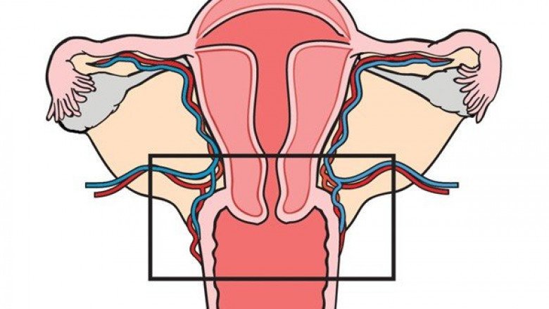 All You Need To Know About the Symptoms of Cervical Dysplasia