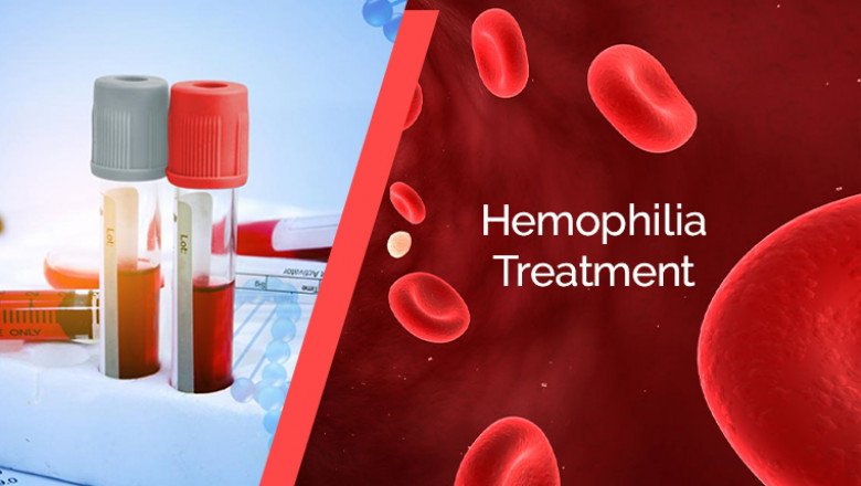 A Hemophilia Treatment that alters the missing blood clotting factor
