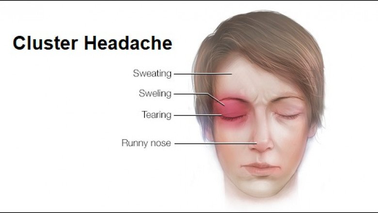 As investment and funding in gene therapy rise, the Cluster Headache Market continues to grow.