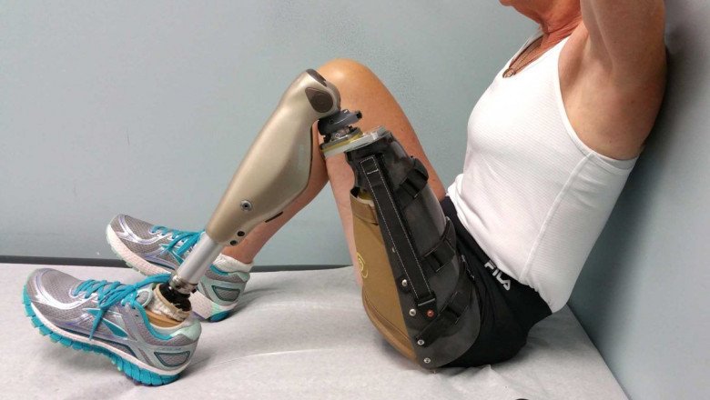 Prosthetic Legs Can Make It Easier For People With Amputations To Move Around