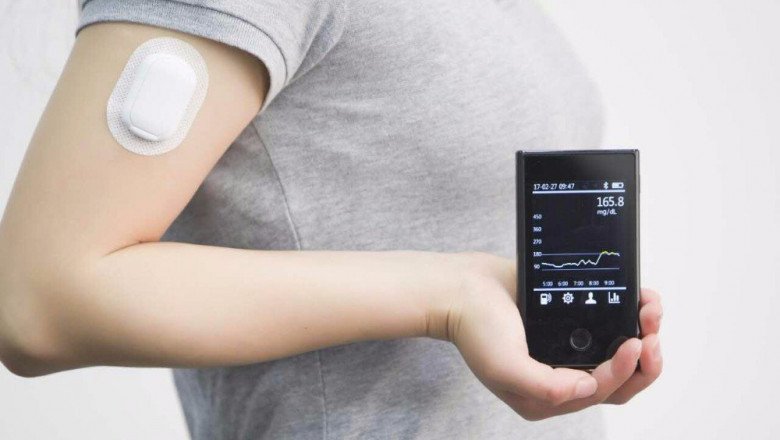 Continual Glucose Monitors (CGM) Devices Keep Track Of And Monitor One's Blood Glucose Throughout The Day