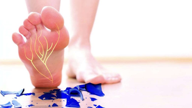 Nerves Throughout The Body Can Be Affected By Diabetic Neuropathy