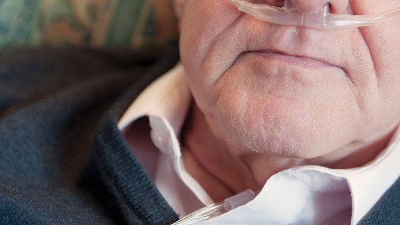 In Order To Treat Patients Or People In Need Of Respiratory Help, Nasal Cannulas (NC) Provide Additional Oxygen Or Increased Airflow