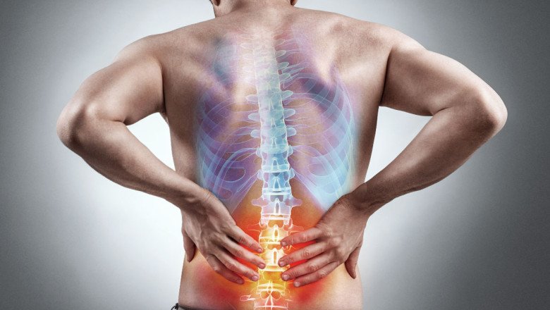 Sciatica Refers To Pain Caused By Irritation Of The Sciatic Nerve