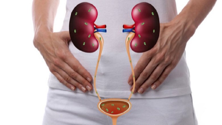 Urinary Tract Infection Therapeutic Involves Using Antibiotics To Eliminate The Infection Causing Symptoms