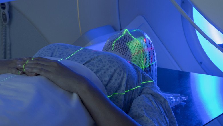 In Rare Circumstances, Radiation Therapy Is Utilized Following Surgery To Stop The Progression Of The Disease
