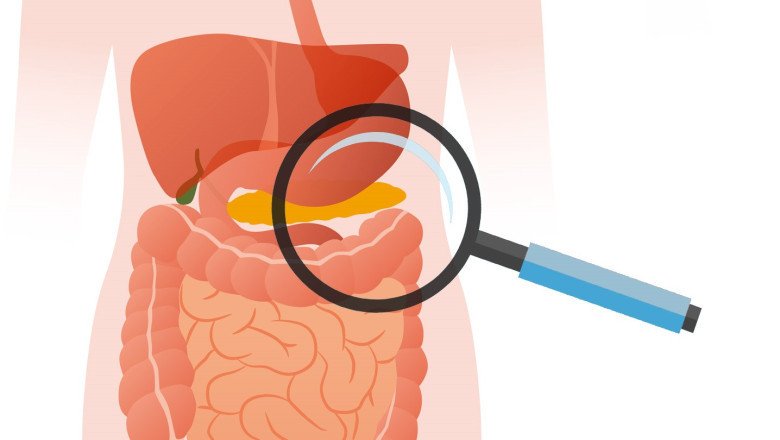 Prescription Exocrine Pancreatic Insufficiency (EPI) Therapeutics: Dosage and Administration Guidelines