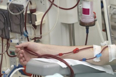 Find At Khandelwal Best Nephrology Hospital in Delhi