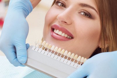 What Are The Benefits Of Teeth Whitening? - Tower House Dental Clinic