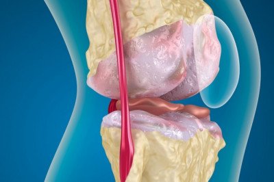 Osteoarthritis Drugs; Help Relieve the Symptoms of Osteoarthritis, Primaril