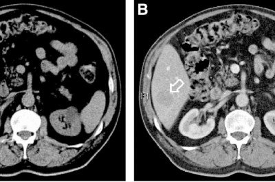 In Medical Imaging, Contrast Media Or Contrast Agents Add Contrast To Structures Or Fluids Within The Body