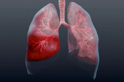 A study of the global Pneumonia Testing Market : trends, market size, growth, opportunity, as well as forecasts for 2022-2028
