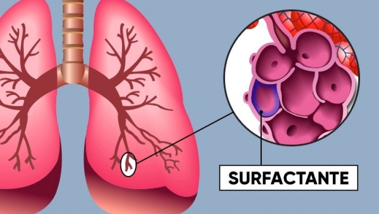 Global Pulmonary Surfactant Market : Trends, Size, Growth, Opportunity, and Forecast to 2022-2030