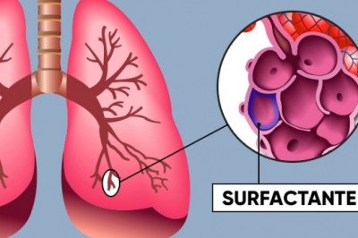 Global Pulmonary Surfactant Market : Trends, Size, Growth, Opportunity, and Forecast to 2022-2030