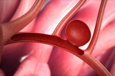 Global Transcatheter Embolization and Occlusion Devices Market : Trends, Size, Growth, Opportunity, and Forecast to 2022-2028