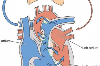 Patients With Eisenmengers Syndrome Will Require Eisenmenger Syndrome Treatment Depending On Their Symptoms And Condition