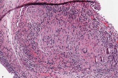 With the growing popularity of whole slide imaging, good analysis and management of these images are becoming increasingly important