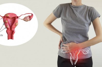 In endometriosis treatment, estrogen or progesterone levels are decreased