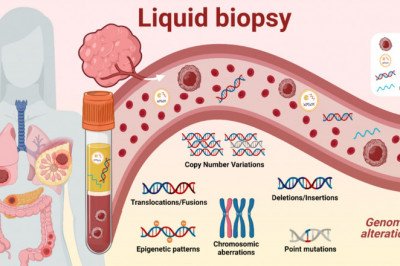 Patient Routine Health Care Has Been Transformed By Liquid Biopsy (LB) For Patients With Lung Cancer
