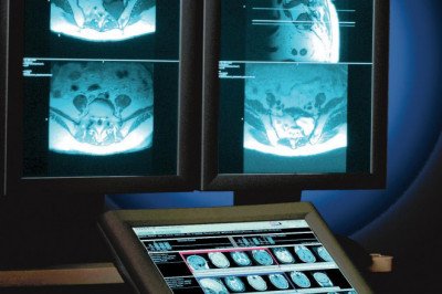 Picture Archiving and Communication System (PACS) Market: Global Industry Trends, Share, Size, Growth, Opportunity and Forecast 2026