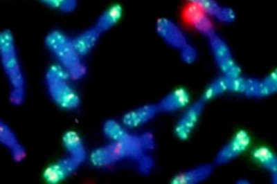 In-situ Hybridization is used to detect miRNAs and chromosomal changes in single cells