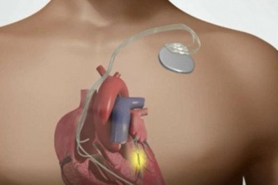 A growing geriatric population and advances in technology will drive the growth of the Implantable Cardiac Pacemaker Market