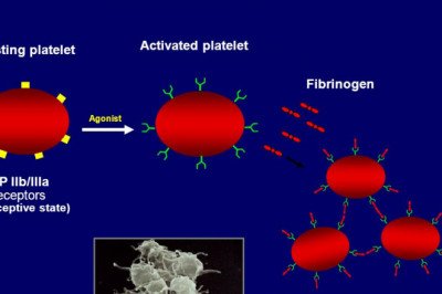Platelet Aggregation Devices Are Used To Determine Platelet Capabilities