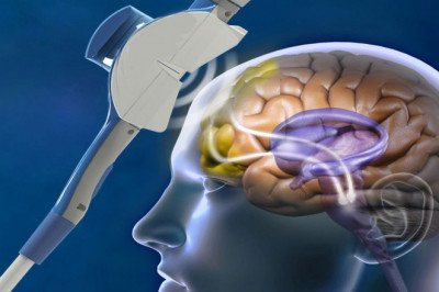 Wireless Visual Cortical Stimulator; used to restore functional vision to the blind