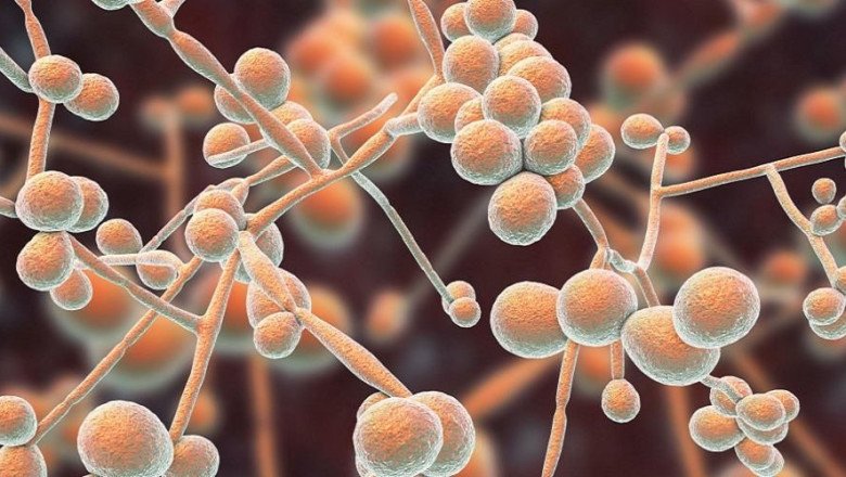 Candidiasis Market Outlook and Overview during the Forecast Period 2018-2026