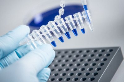 Molecular Biology Relies Heavily On Polymerase Chain Reaction (PCR)