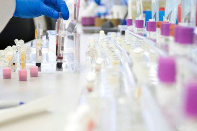Biobanking Market: Size, Share & Trends To 2033