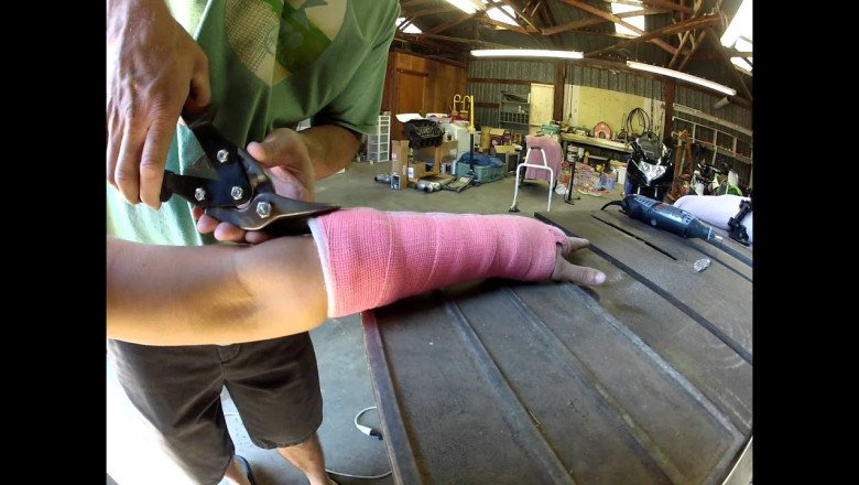 The use of cast removal devices is increasing due to the increase in sports injuries, physical damage, and accidents.