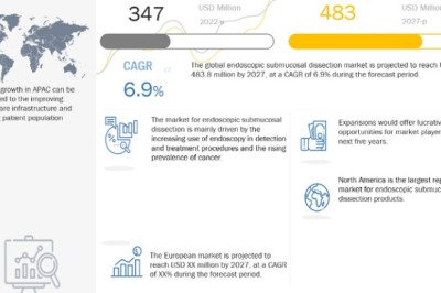 Endoscopic Submucosal Dissection Market Size Worth US$ 483 Million by 2027 | Growth Rate (CAGR) 6.9%