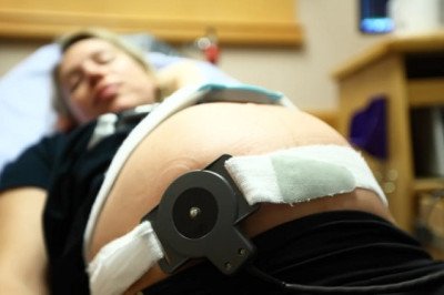The Role of Fetal and Neonatal Monitoring in Identifying and Preventing Birth Complications