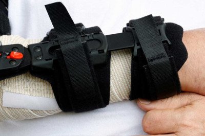 Challenges and Opportunities in the Cast Removal Device Market