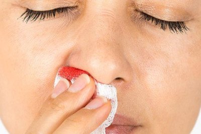 Geographical Analysis of Epistaxis Market, Forecast 2019-2027