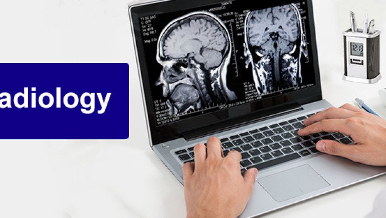 Teleradiology Services Market: Key Players and Competitive Landscape Analysis