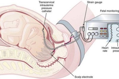 The Role of Artificial Intelligence in Fetal and Neonatal Monitoring