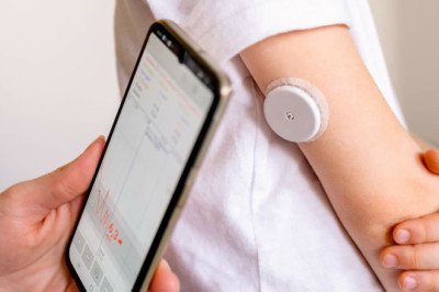 In Continuous Glucose Monitoring (CGM) Devices, A Graphical Display Shows Glucose Trends